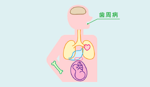 歯周病治療 画像